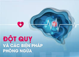 7 Cách Đơn Giản Để Giảm Nguy Cơ Đột Quỵ Ngay Ngày Hôm Nay