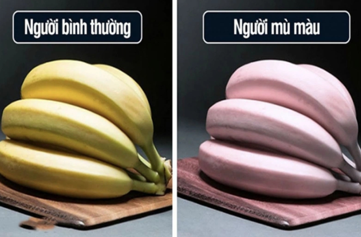 Bệnh mù màu là gì? Nguyên nhân và cách điều trị mù màu