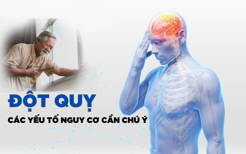 Đột Quỵ: Hiểu Rõ Để Bảo Vệ Bản Thân Và Gia Đình
