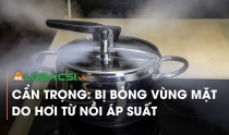 Cẩn trọng: Bị bỏng vùng mặt do hơi từ nồi áp suất