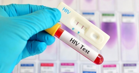 Xét nghiệm HIV tại Bệnh viện Thống Nhất bao nhiêu tiền?