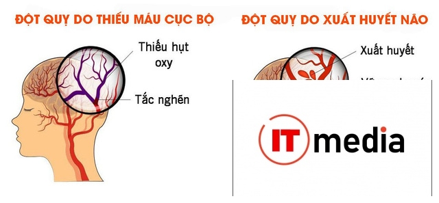 1 nhồi màu