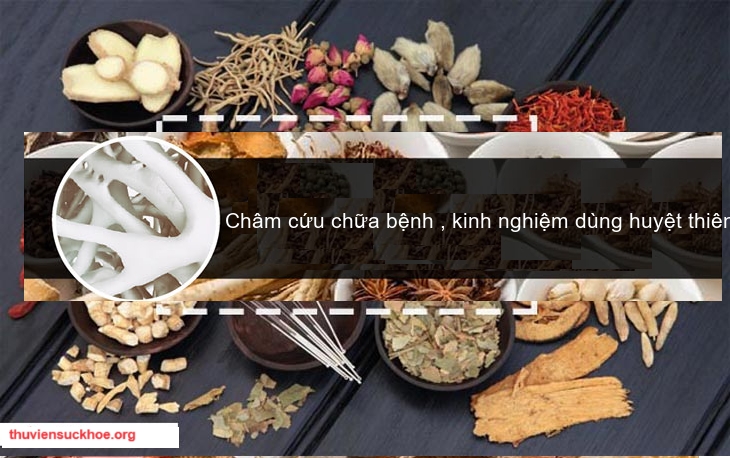 Châm cứu chữa bệnh , kinh nghiệm dùng huyệt thiên ứng